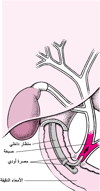 فَهم تصوير البنكرياس والقنوات الصفراويَّة التنظيري بالطريق الرَّاجع (ERCP)