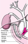 Conoscere la colangiopancreatografia retrograda endoscopica (CPRE)