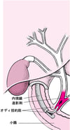 内視鏡的逆行性胆道膵管造影（ERCP）検査について理解する