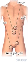 المواضع الشائعة للفتوق