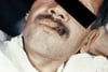 Histoplasmose