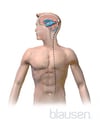 Shunt in Hydrocephalus