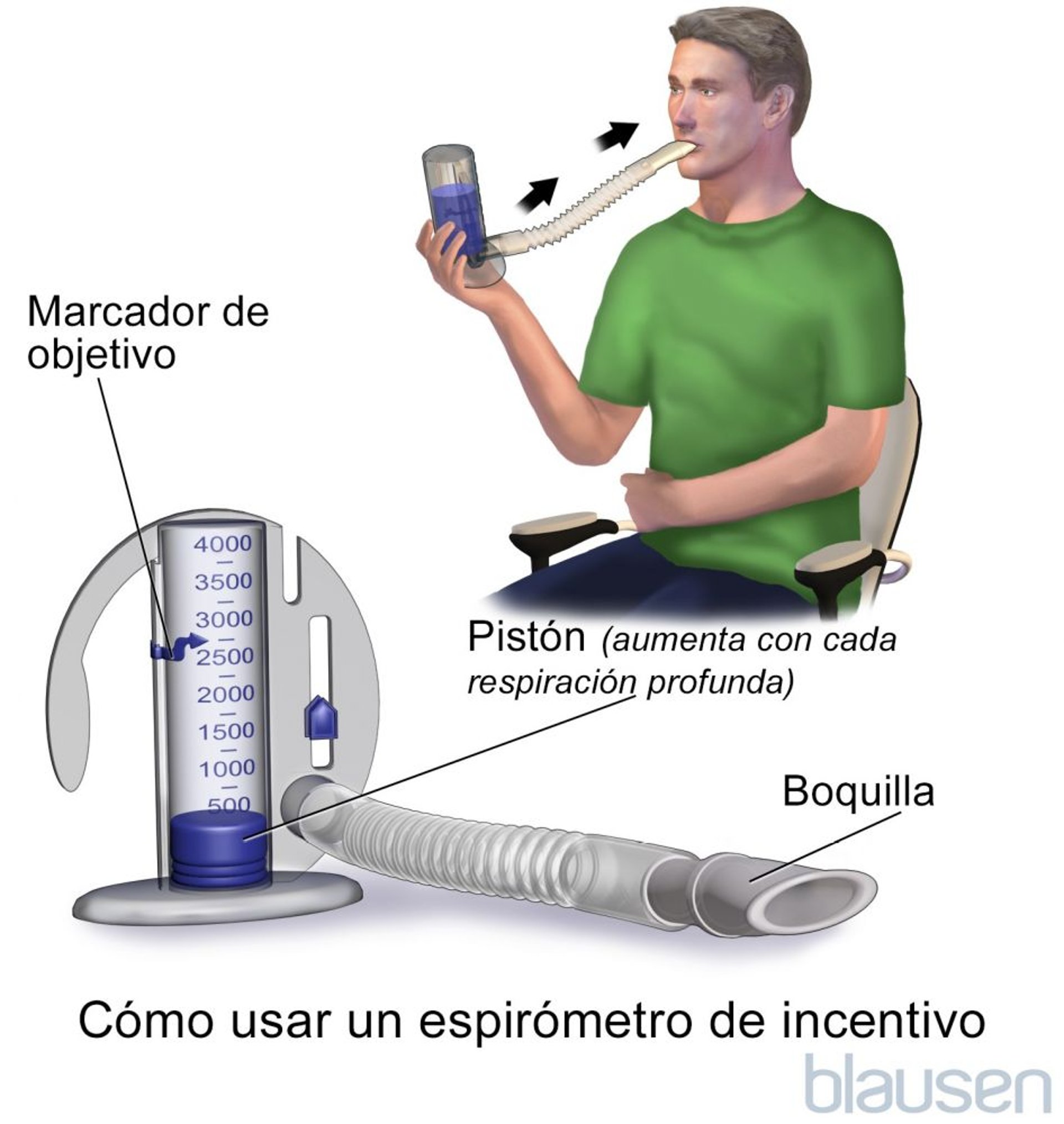 Espirometría incentivada