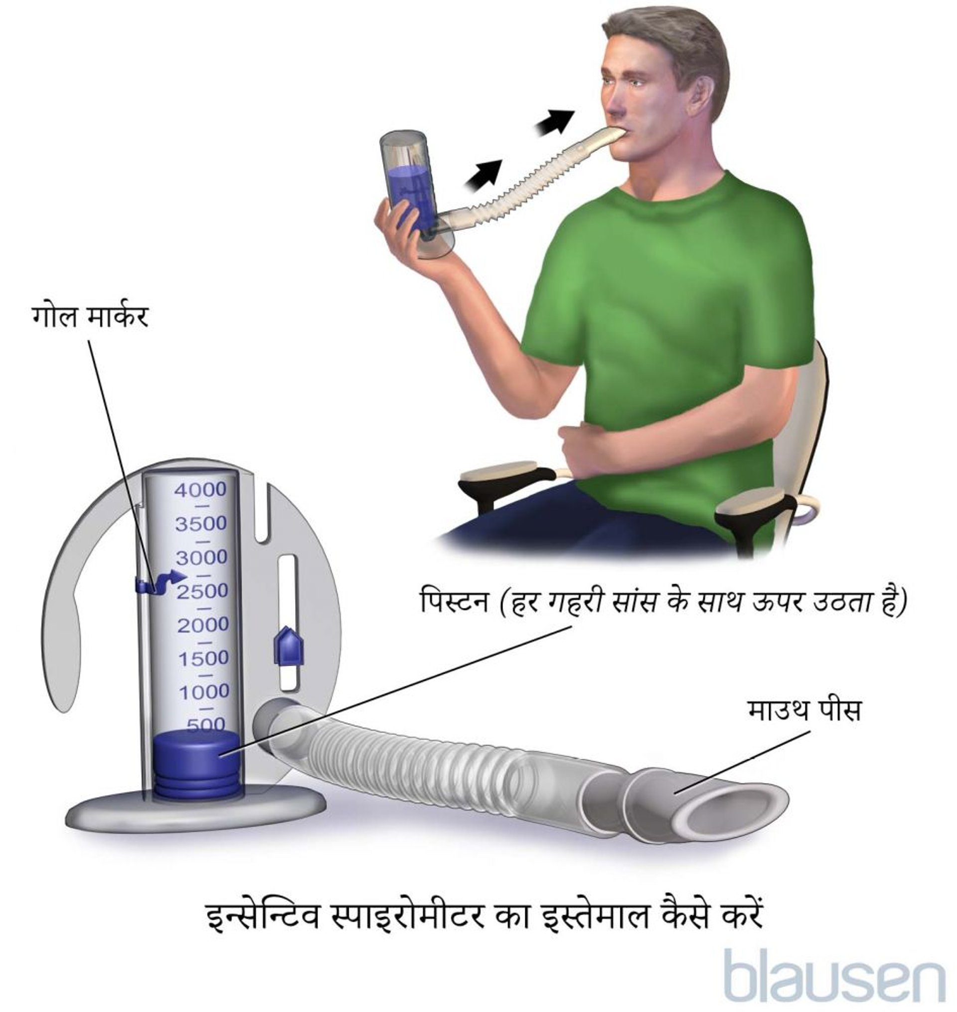 इंसेंटिव स्पाइरोमीटर