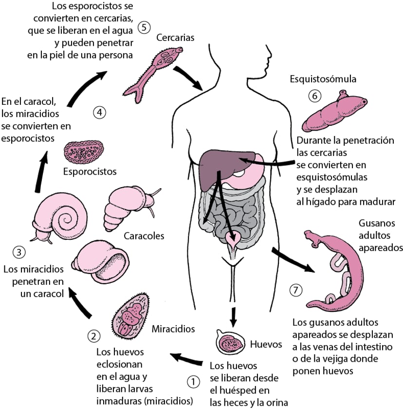 Esquistosomiasis - Infecciones - Manual MSD versión para público general