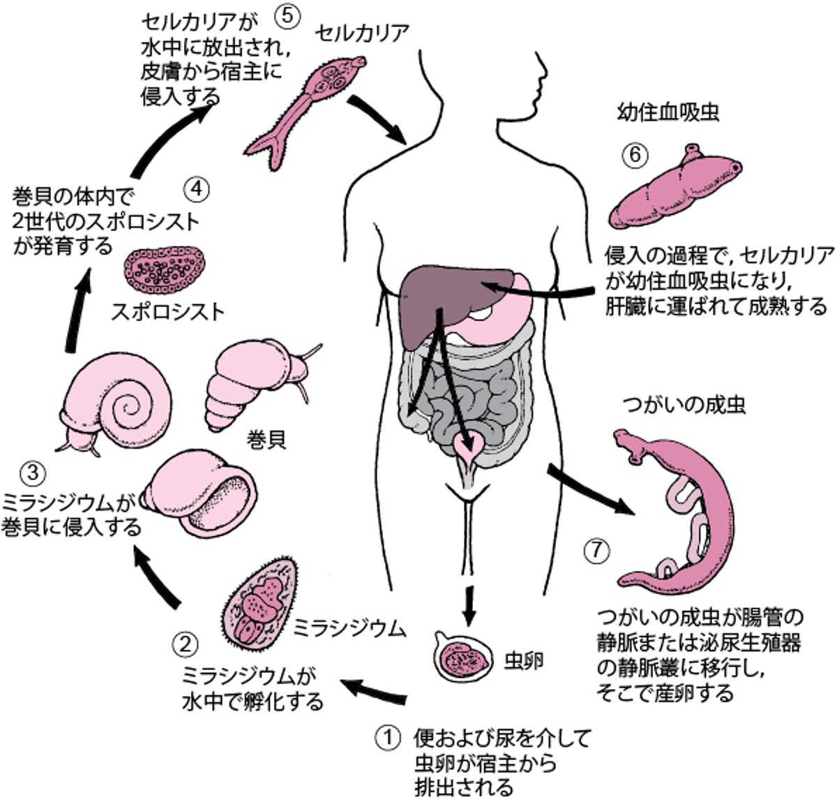 住血吸虫（<i >Schistosoma</i>）のライフサイクル