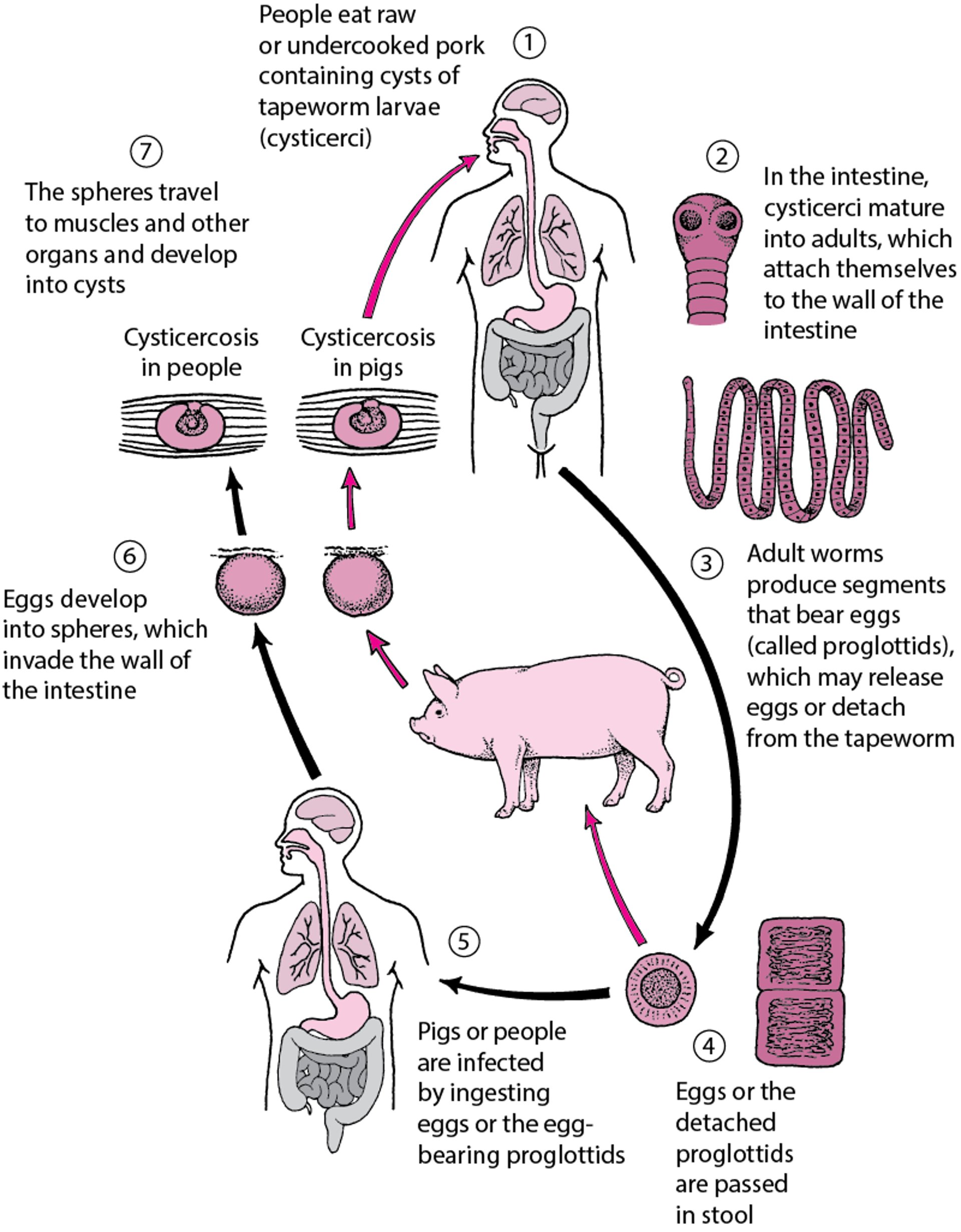 Image Life Cycle Of The Pork Tapeworm MSD Manual Consumer Version image-life-cycle-of-the-pork-tapeworm-msd-manual-consumer-version