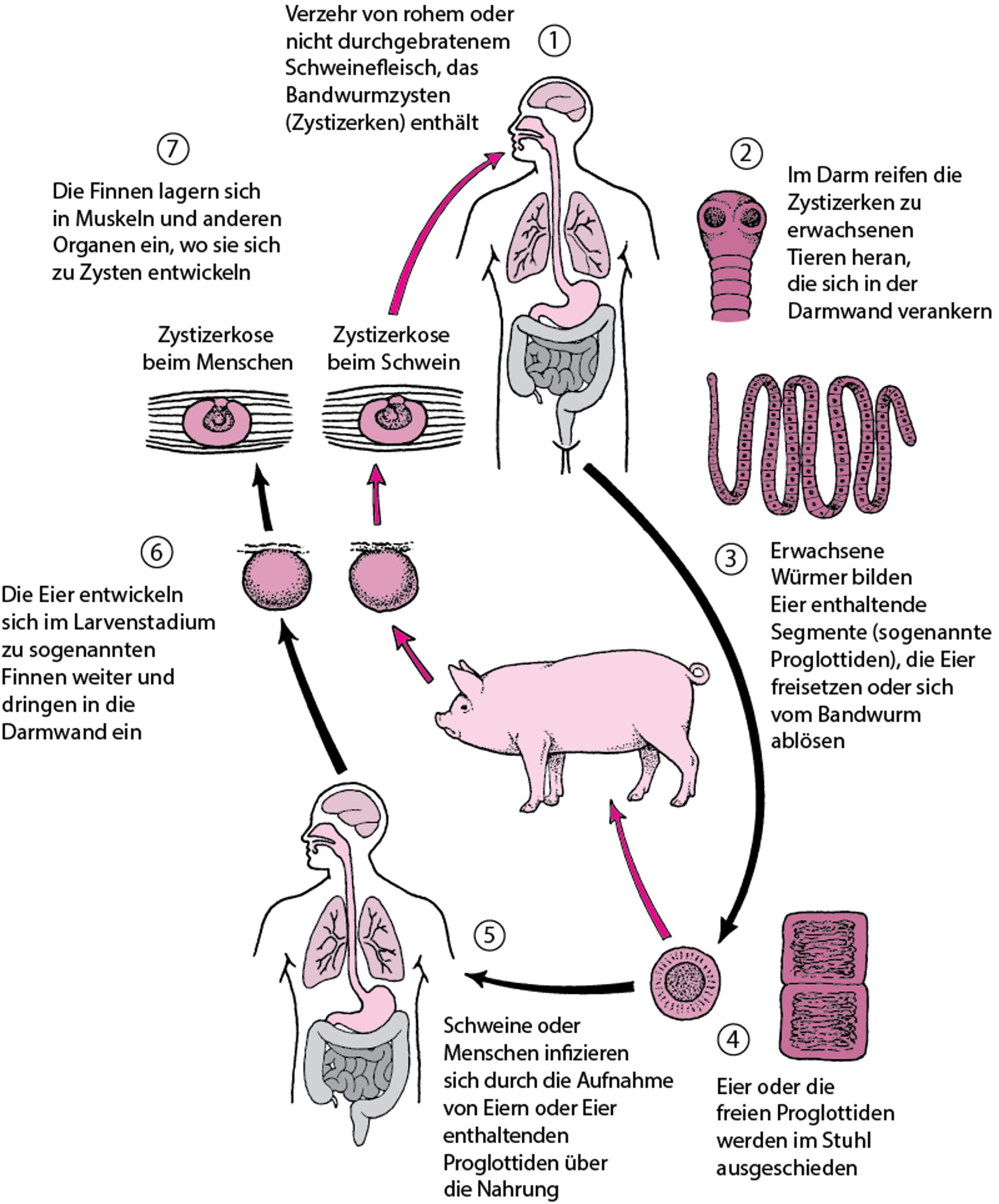 Lebenszyklus des Schweinebandwurms