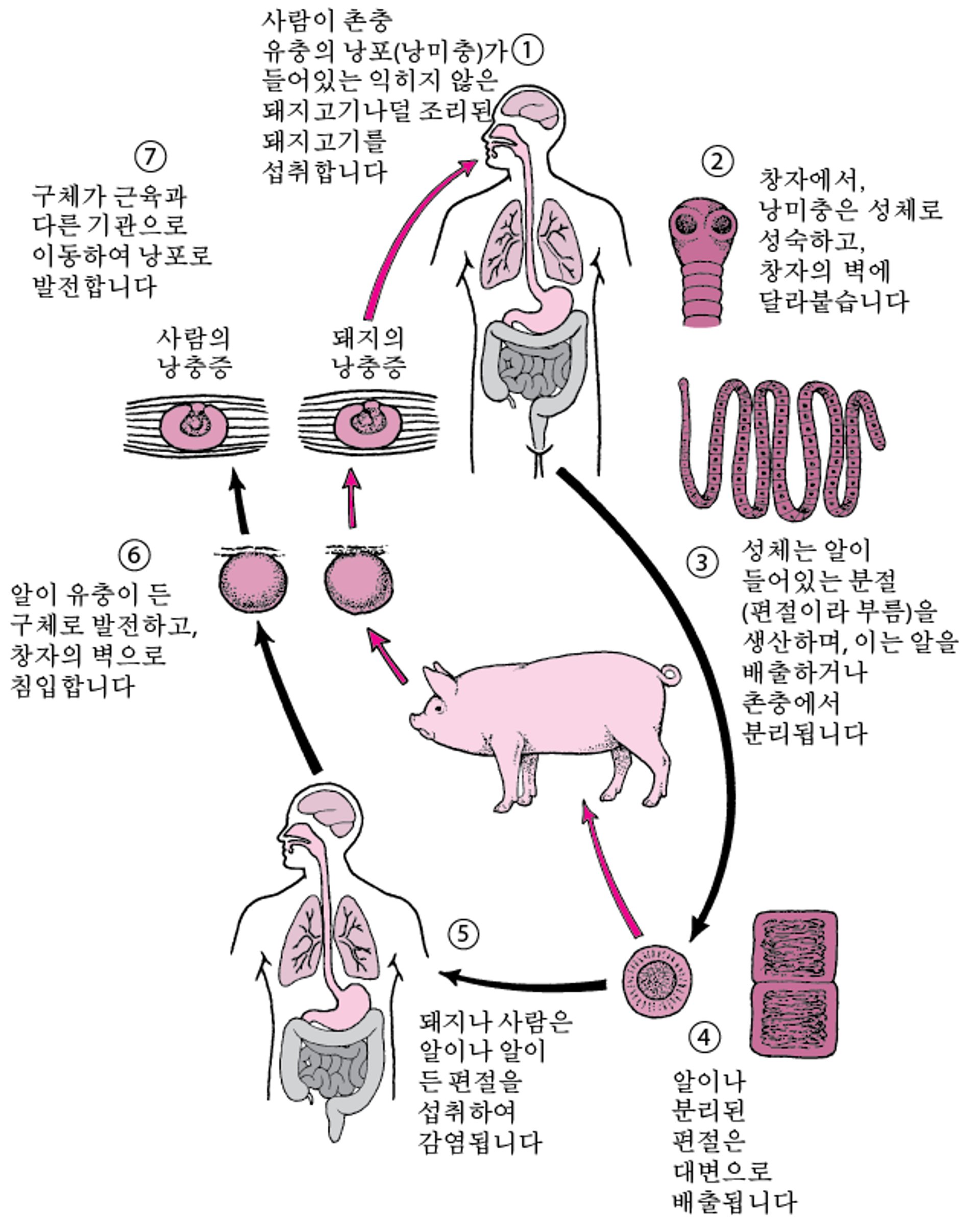 갈고리 촌충의 수명 주기