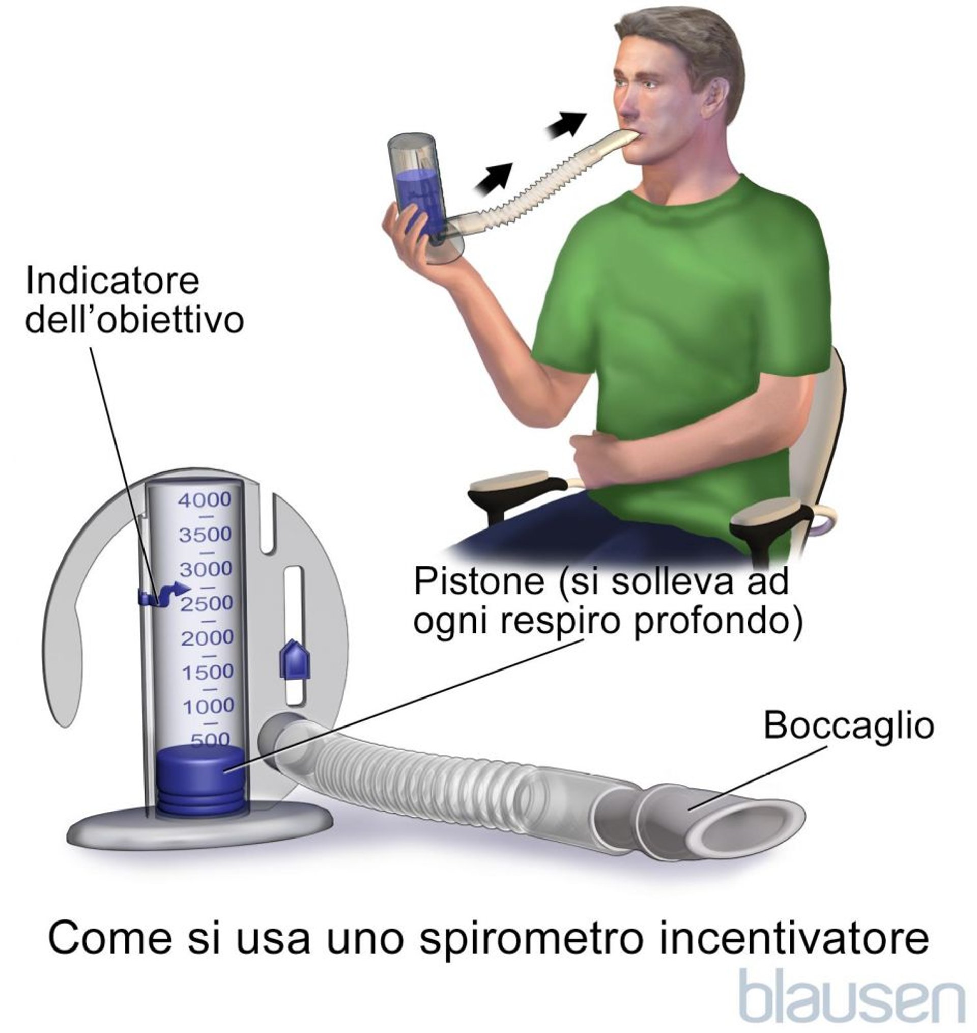 Spirometria incentivata