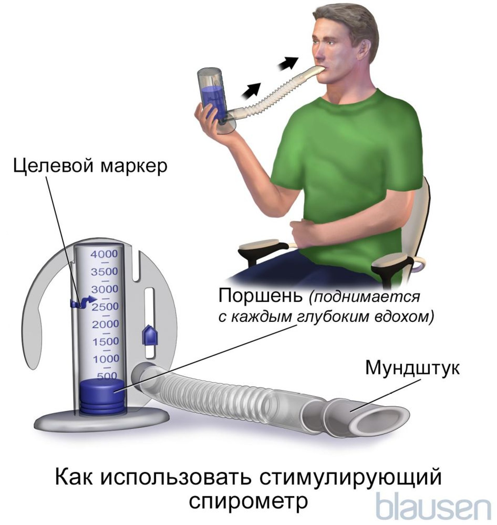 Устройство для стимулирующей спирометрии