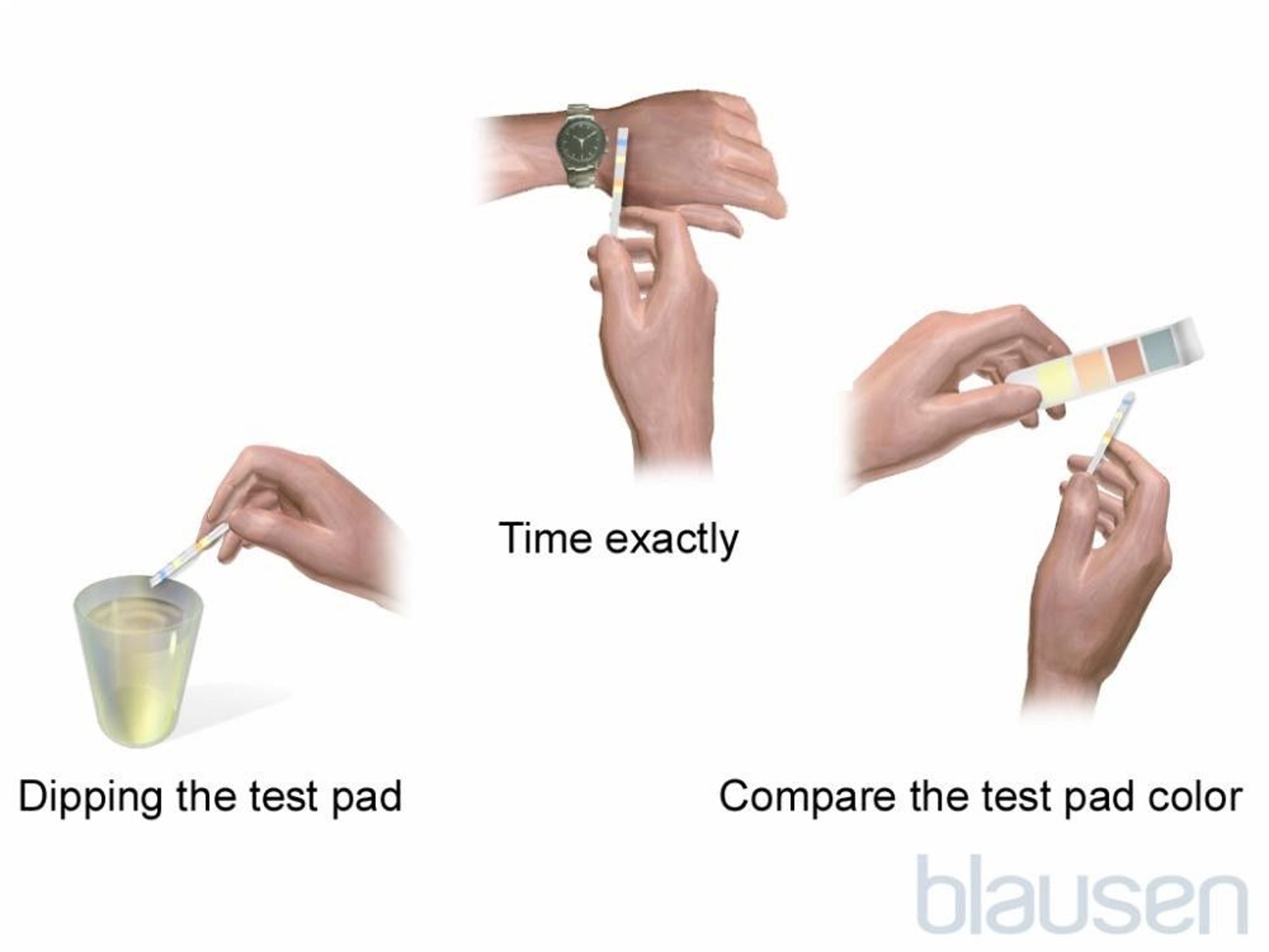 Dipstick Urine Test