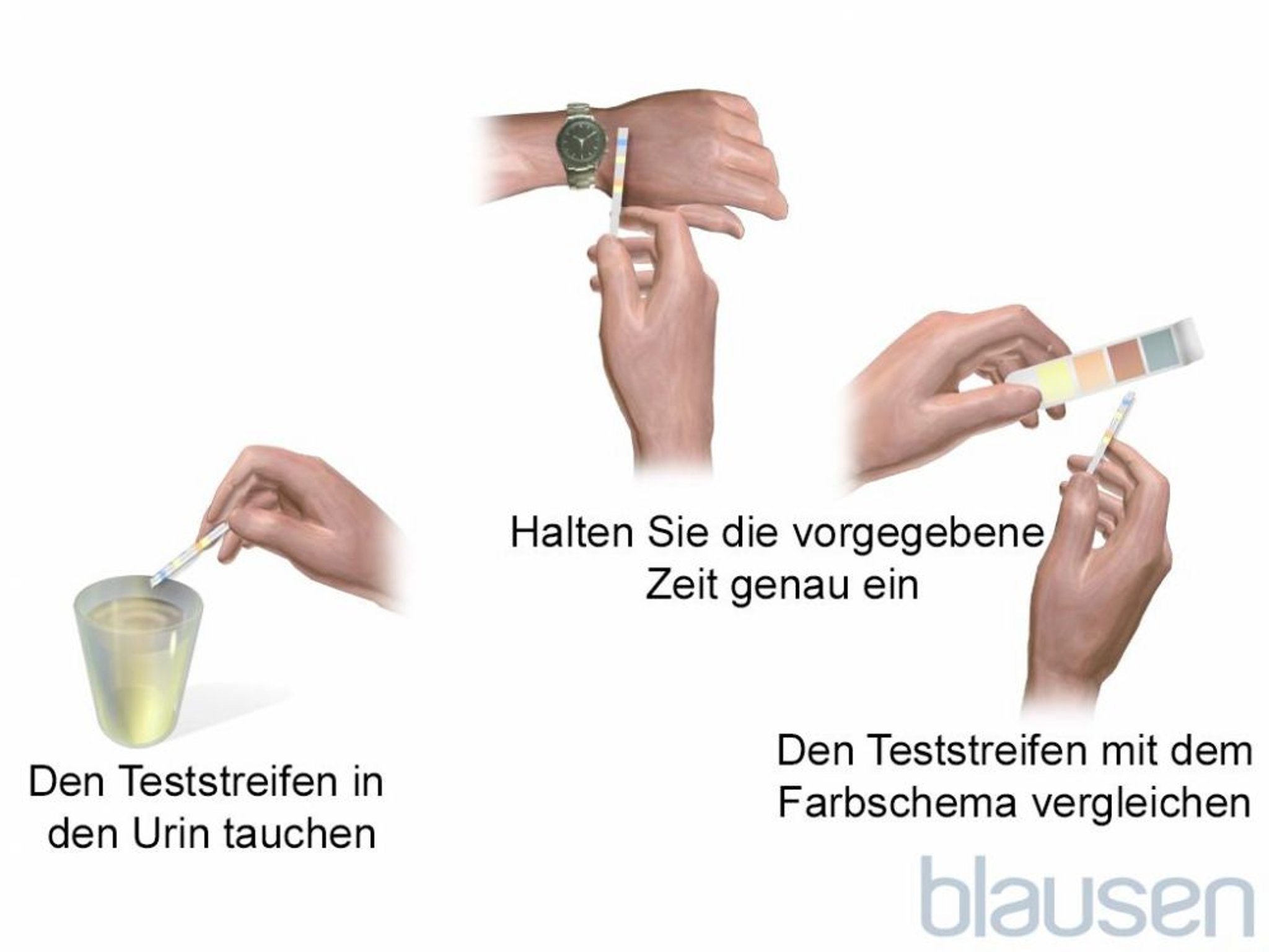 Teststreifen-Urintest