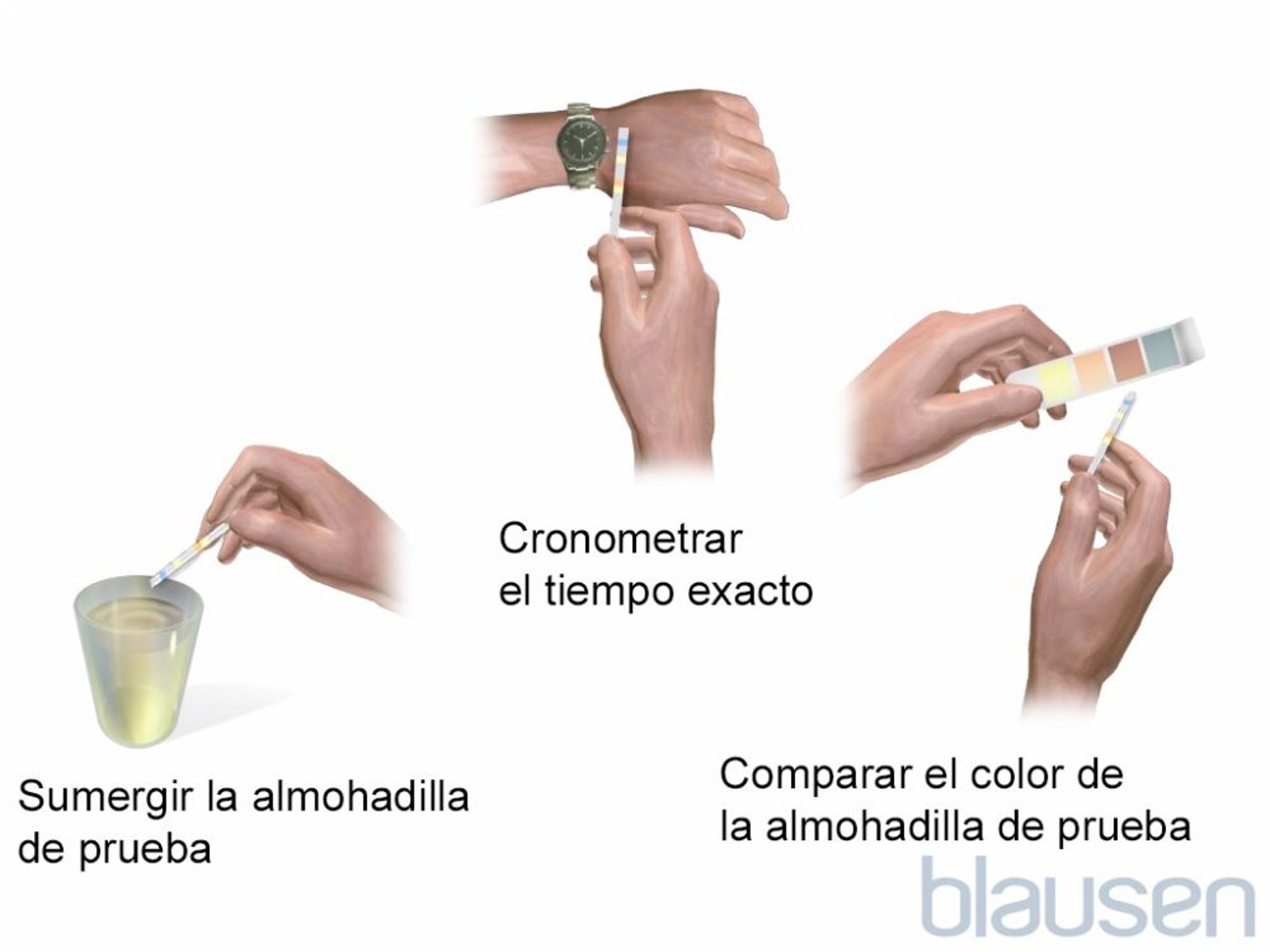 Prueba de orina con tira reactiva