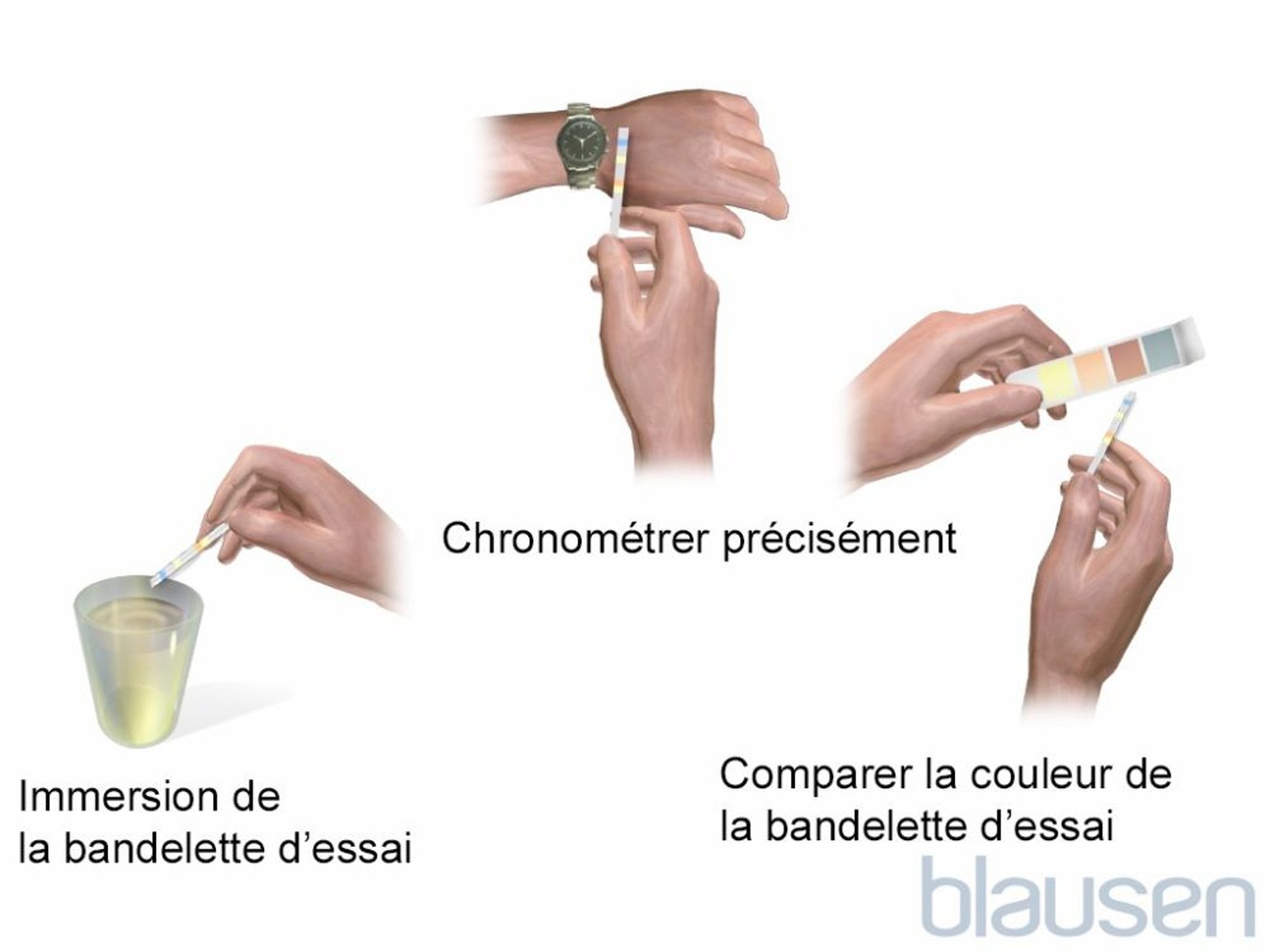 Test urinaire sur bandelette