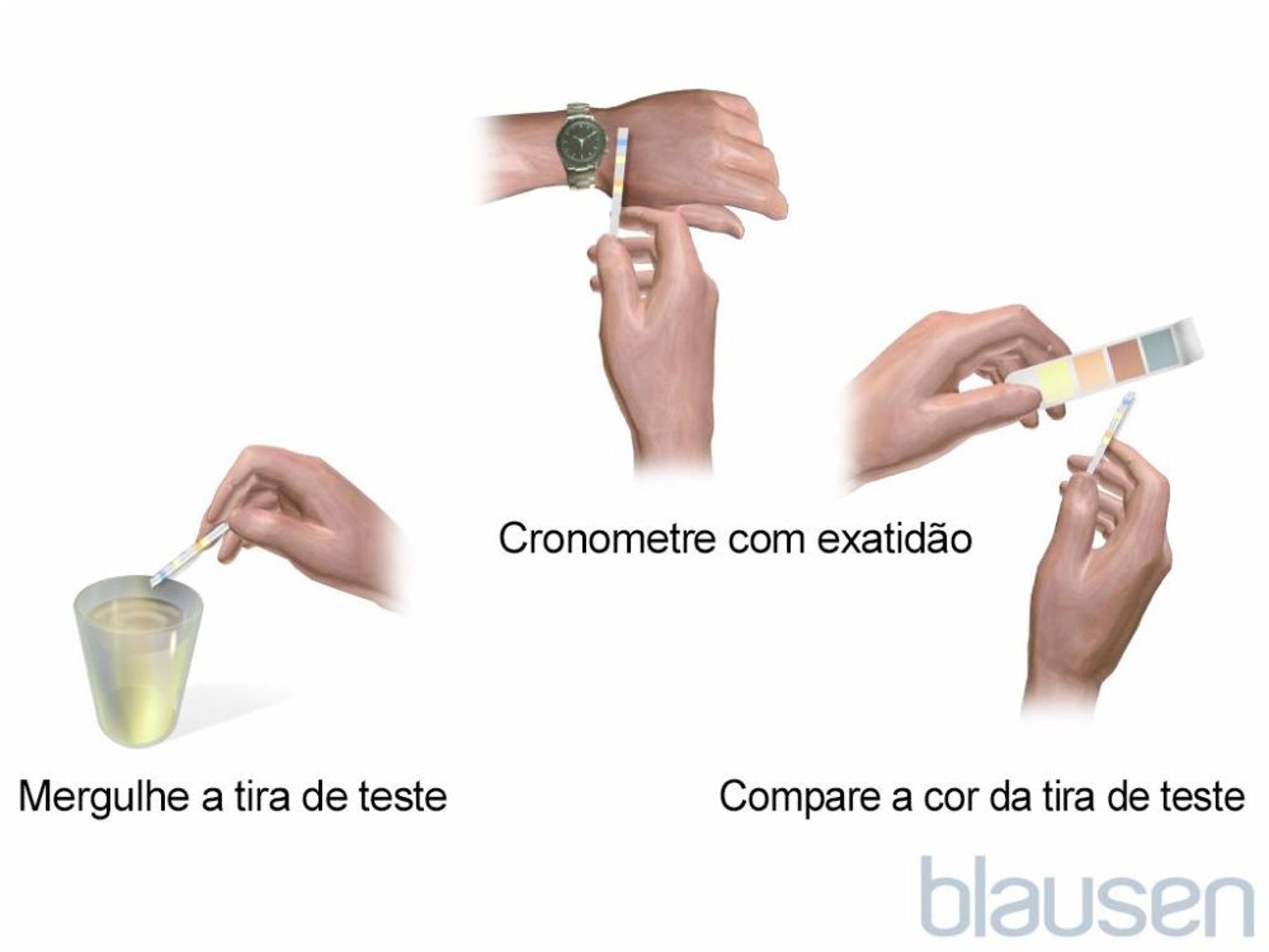 Tira reagente para exame de urina