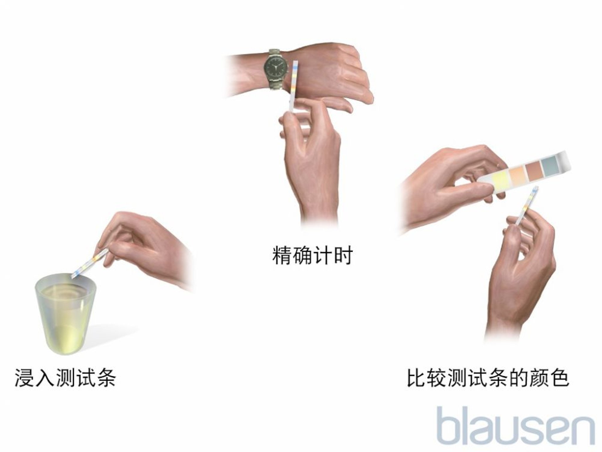 尿试纸检查