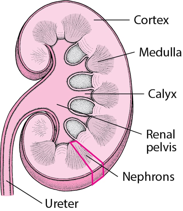 Stones in the Urinary Tract - Urinary Tract Disorders - Merck Manual ...