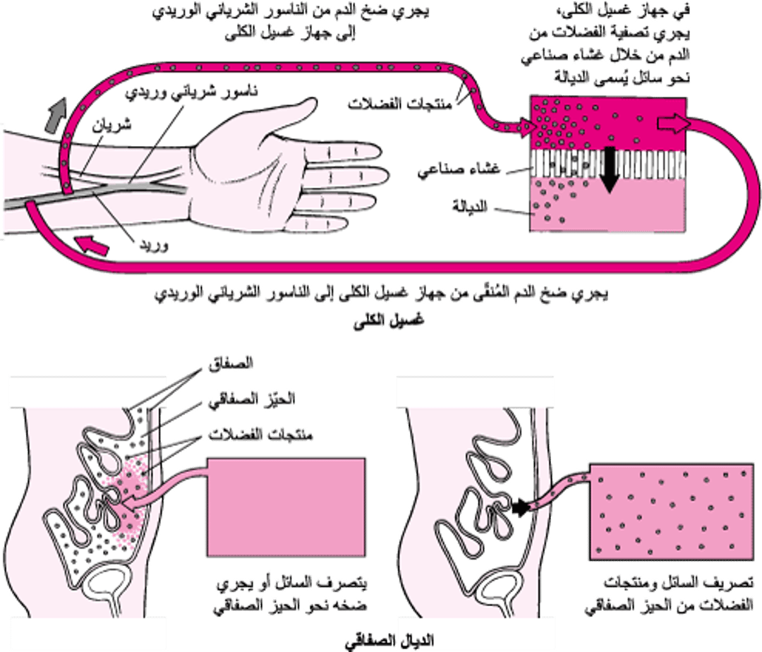 مقارنة بين الديال الدَّموي والديال الصِّفاقي