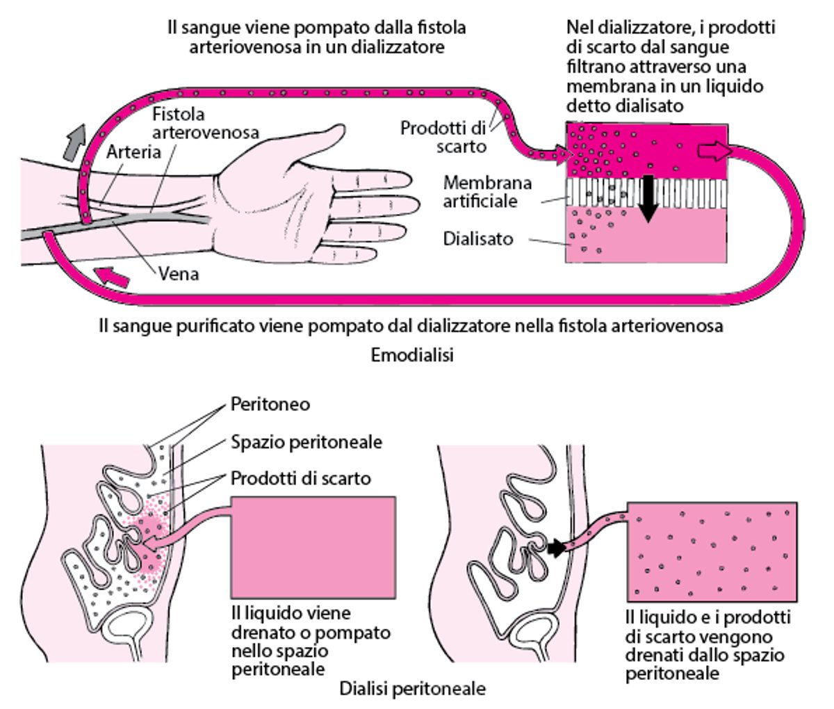 Confronto tra emodialisi e dialisi peritoneale