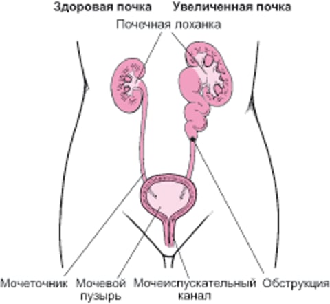 Увеличенная почка