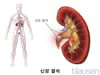 신장 결석