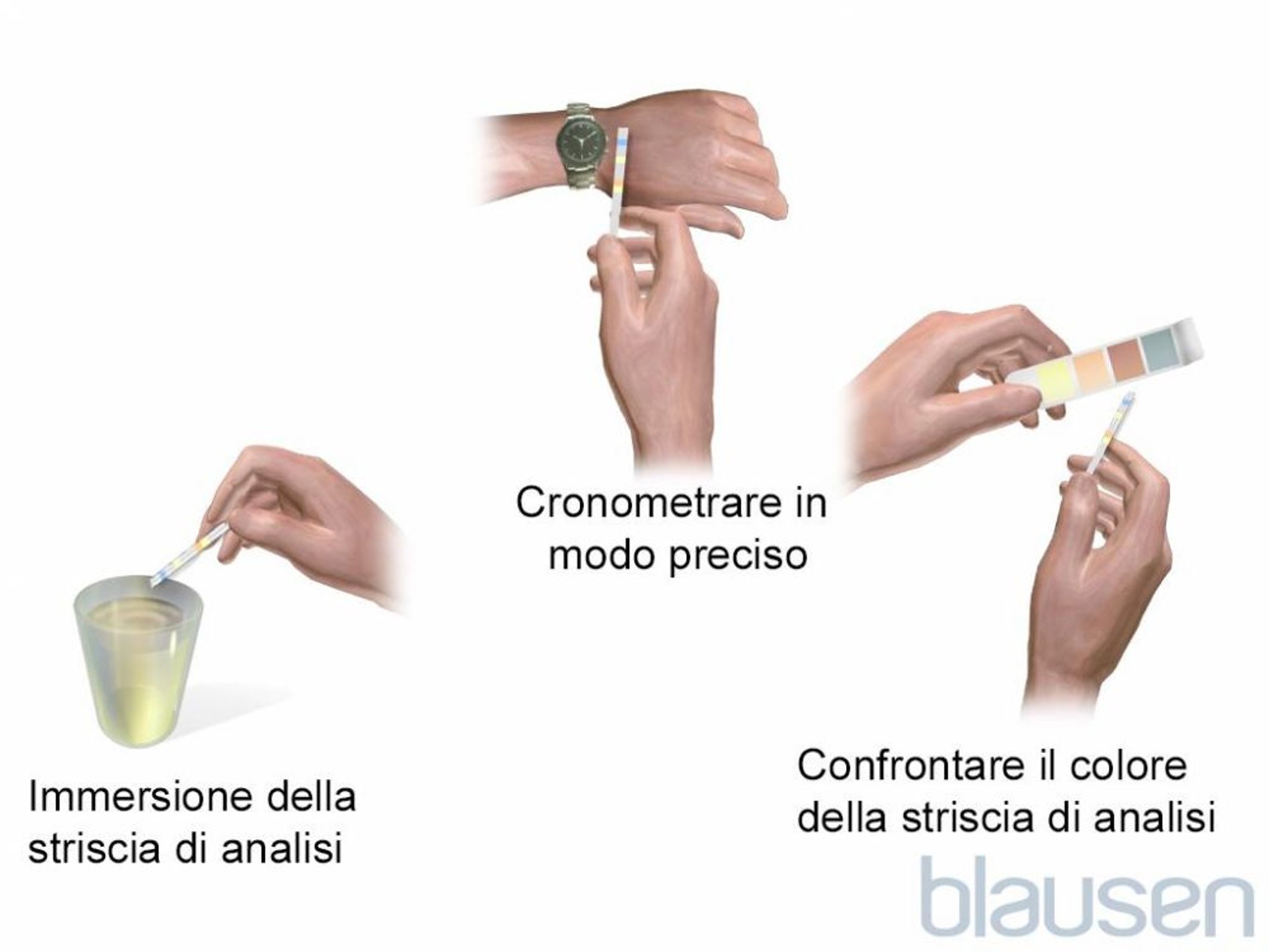 Esame delle urine con strisce reattive