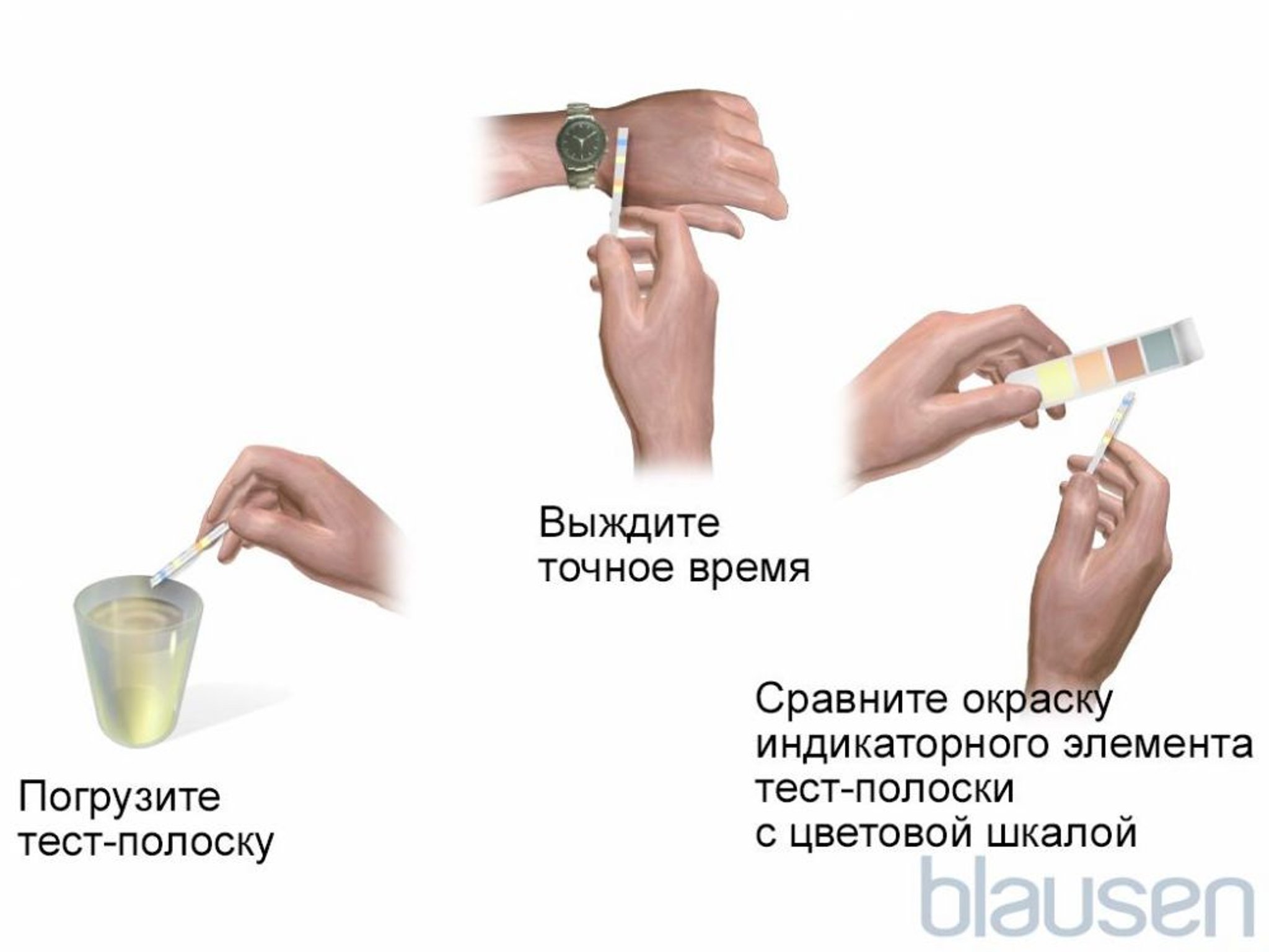 Анализ мочи с использованием тест-полоски