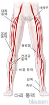 다리 동맥