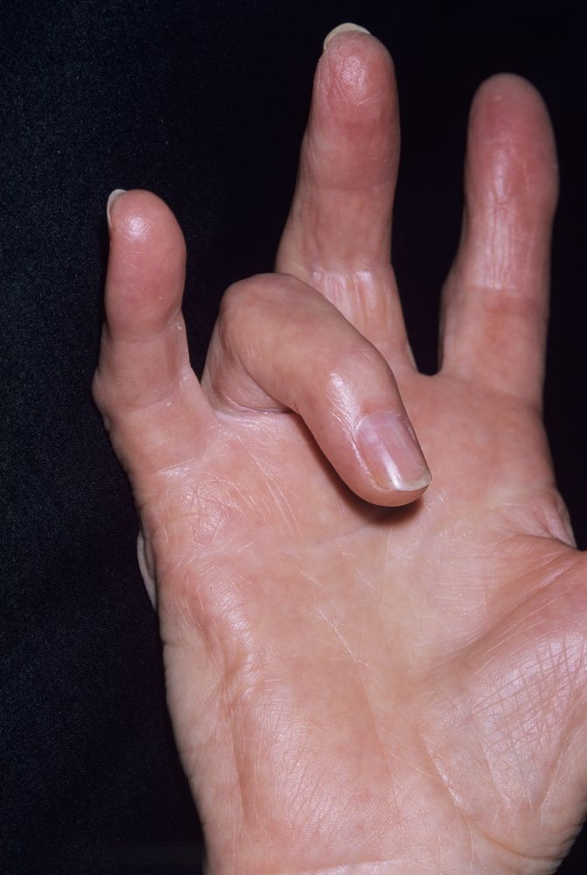 Schnellender Finger