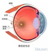 黄斑変性
