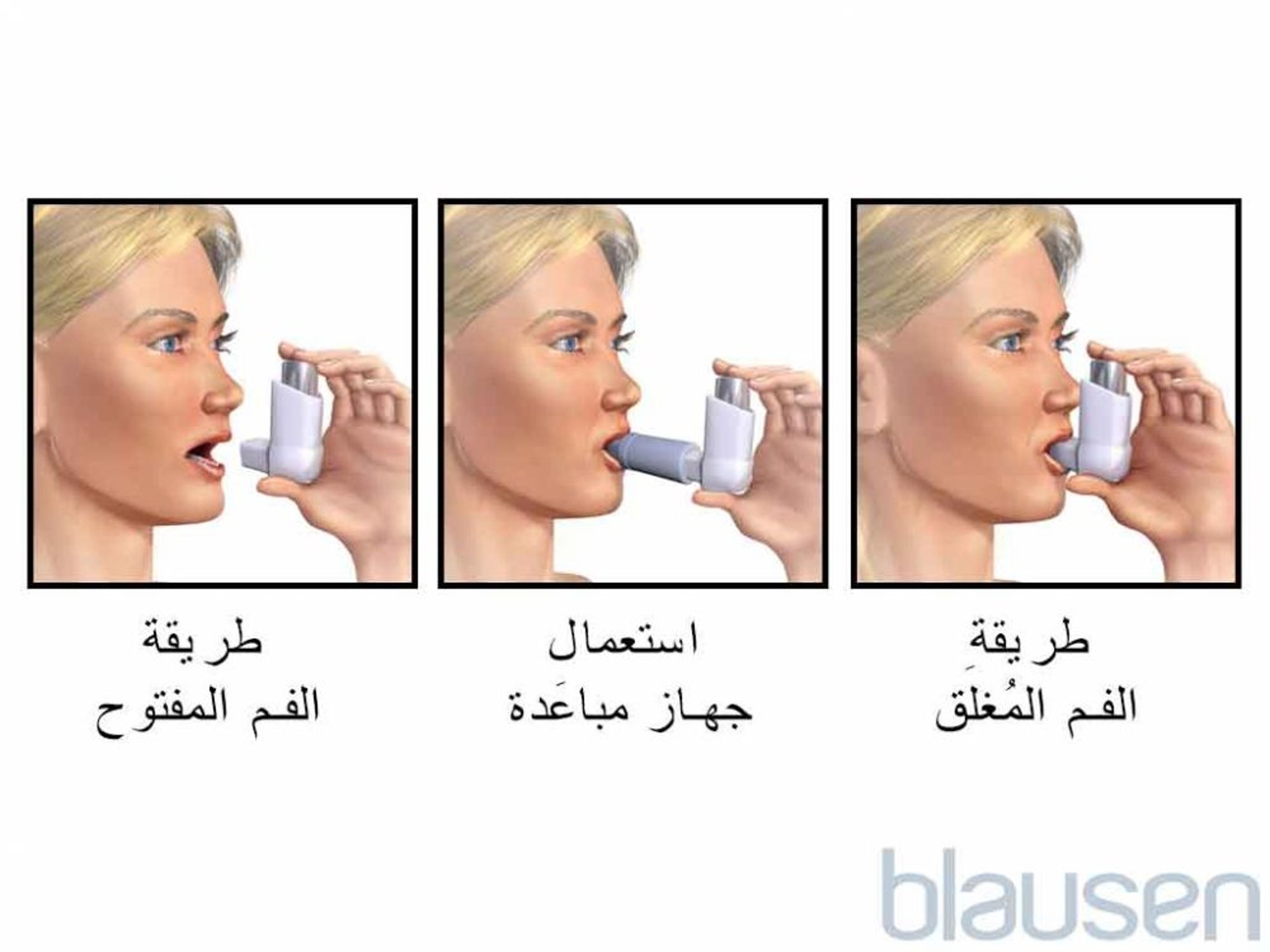 جِهاز استنشاق بجرعة مقيسة