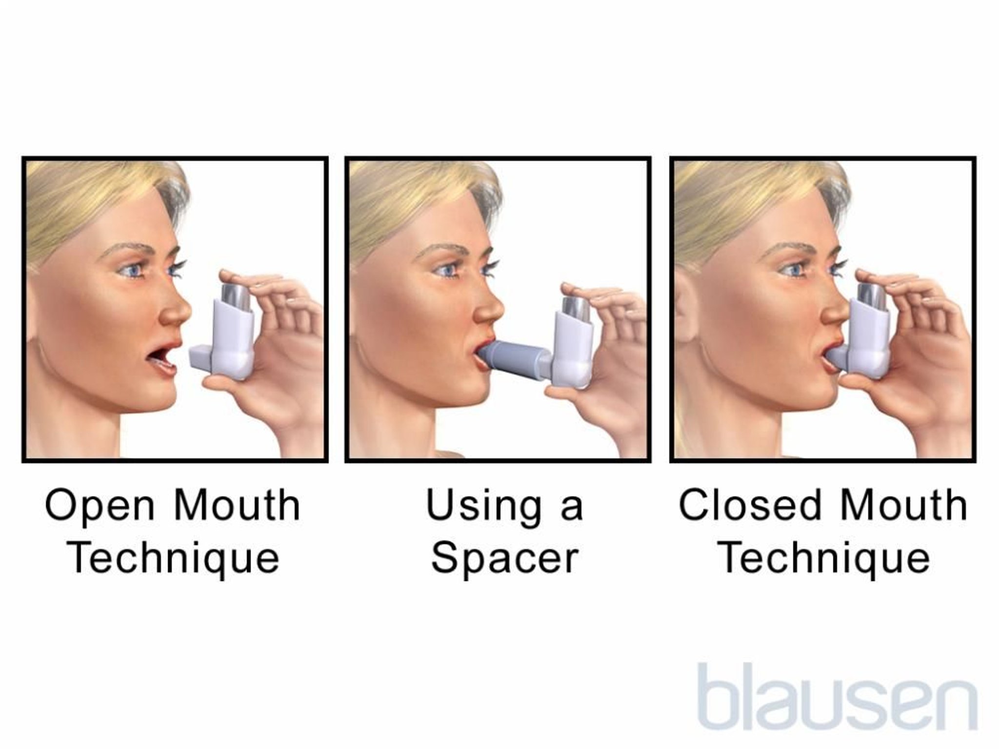 Inhalador de dosis medida