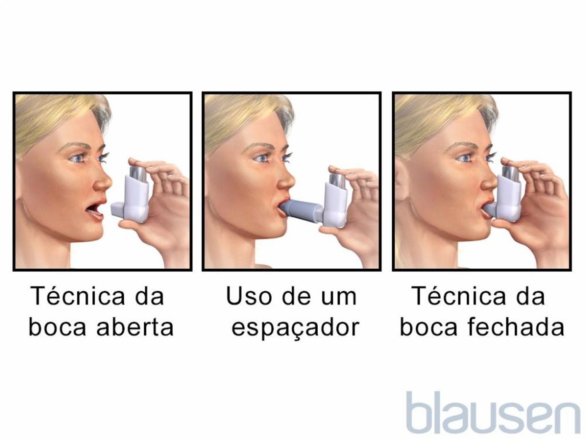 Inalador de doses controladas