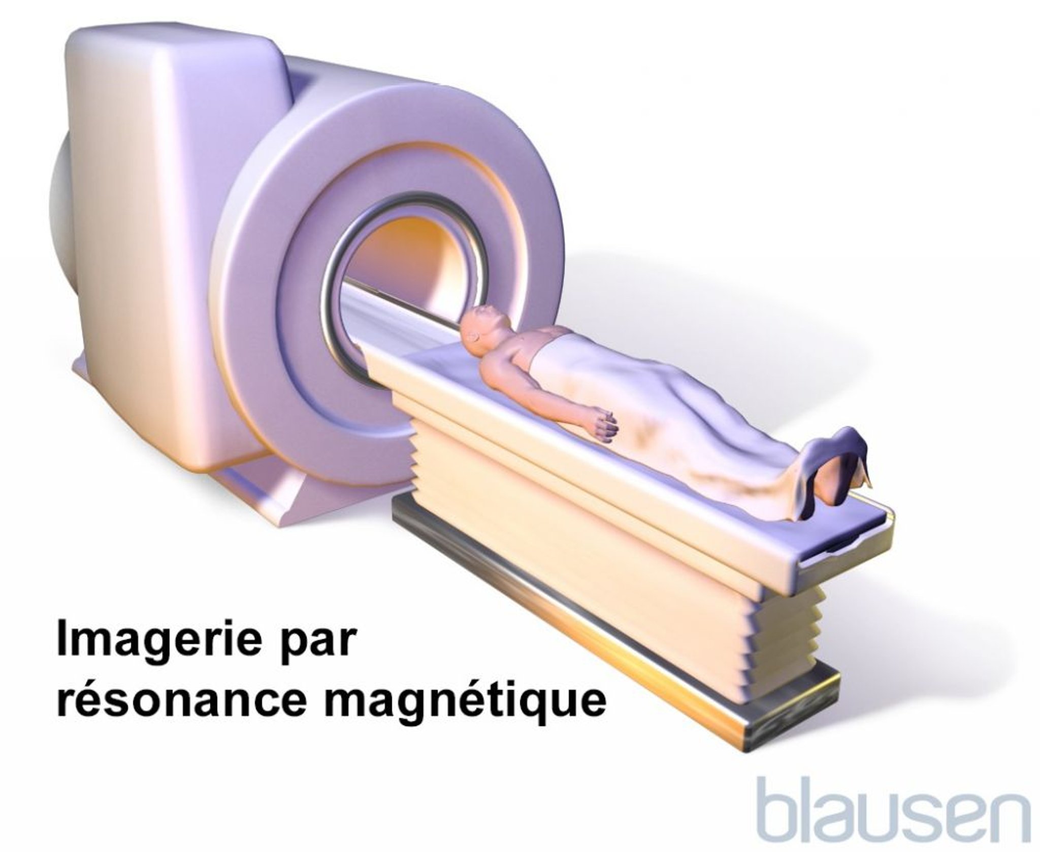 Imagerie par résonance magnétique (IRM)