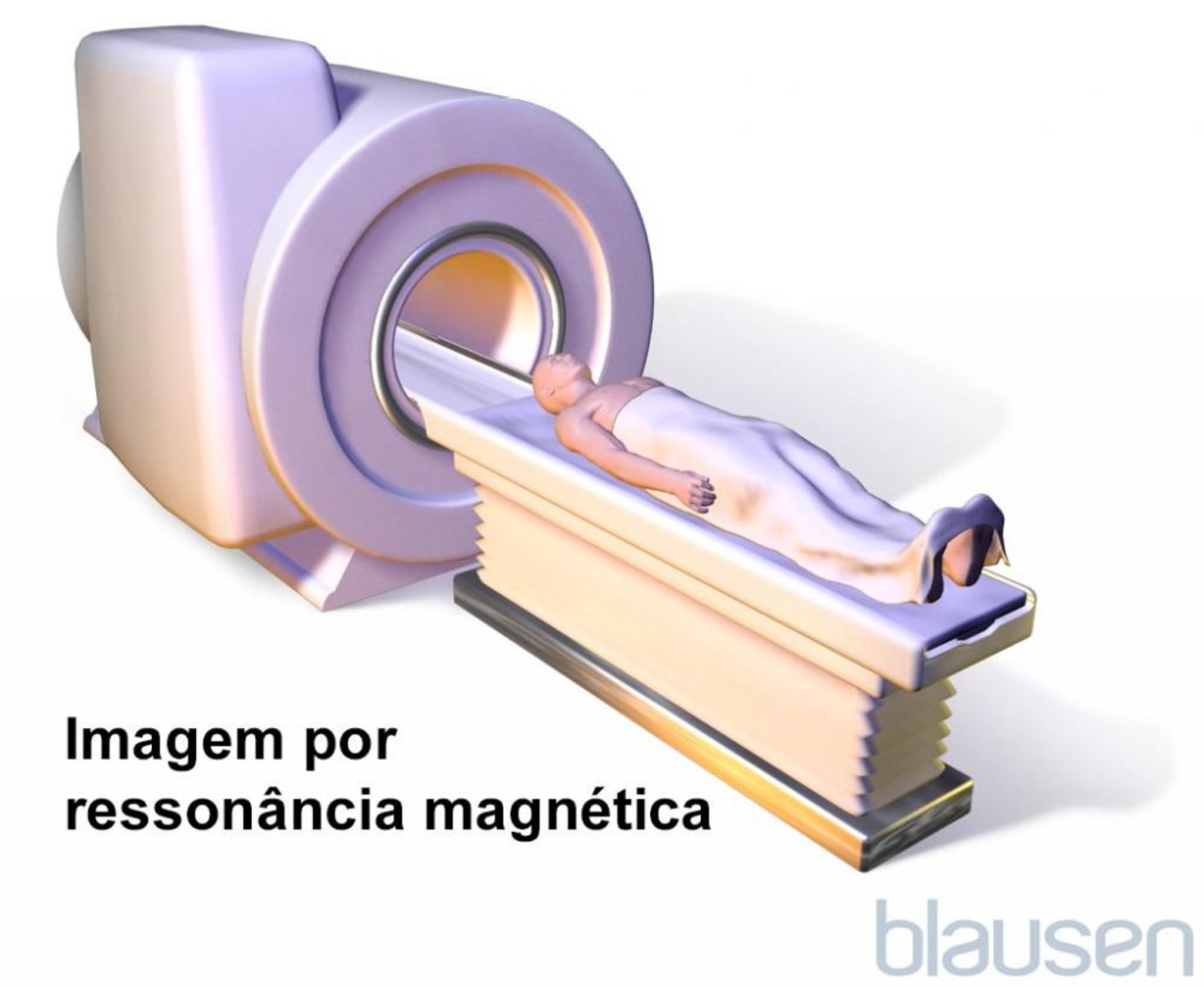 Ressonância magnética (RM)