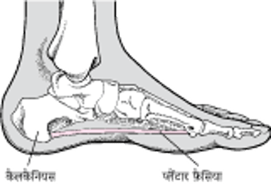 प्लैंटार फ़ैसिया