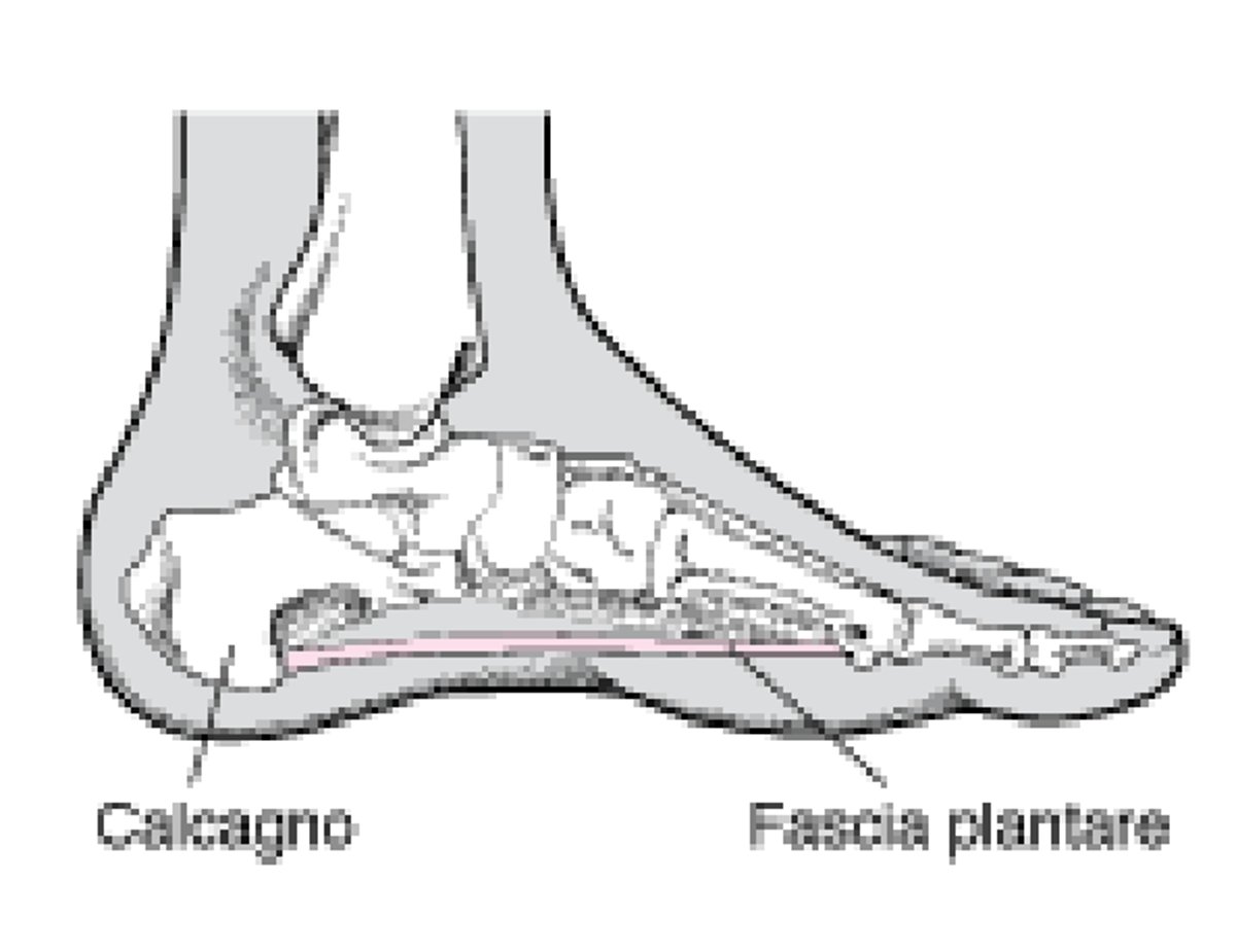 Fascia plantare