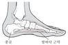 발바닥 근막