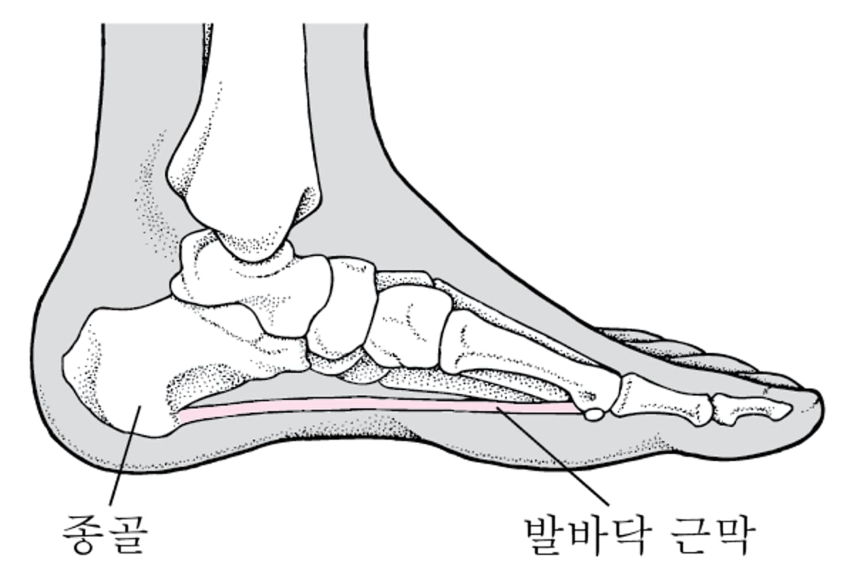 발바닥 근막