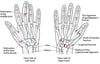 Common Hand Injuries
