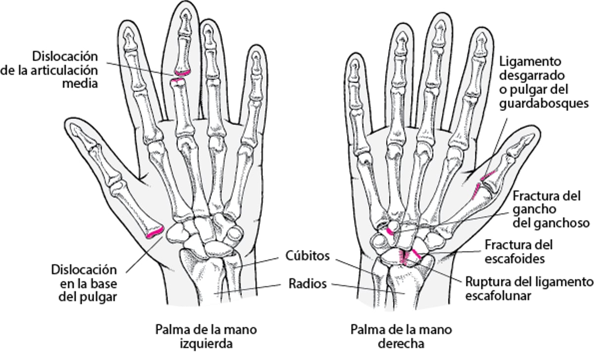 Lesiones comunes de la mano