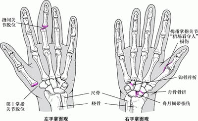 常见手部损伤