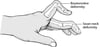 When the Fingers Are Abnormally Bent