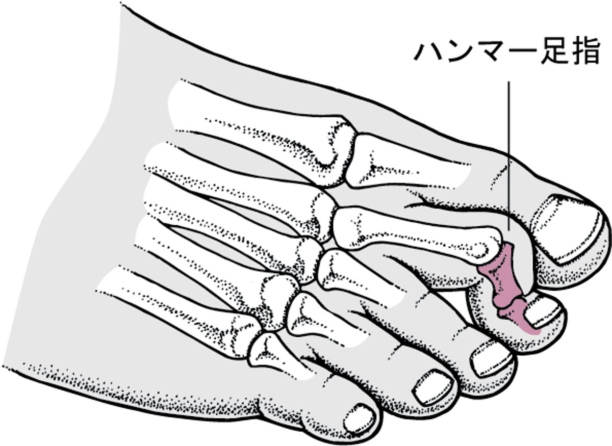 つちゆび