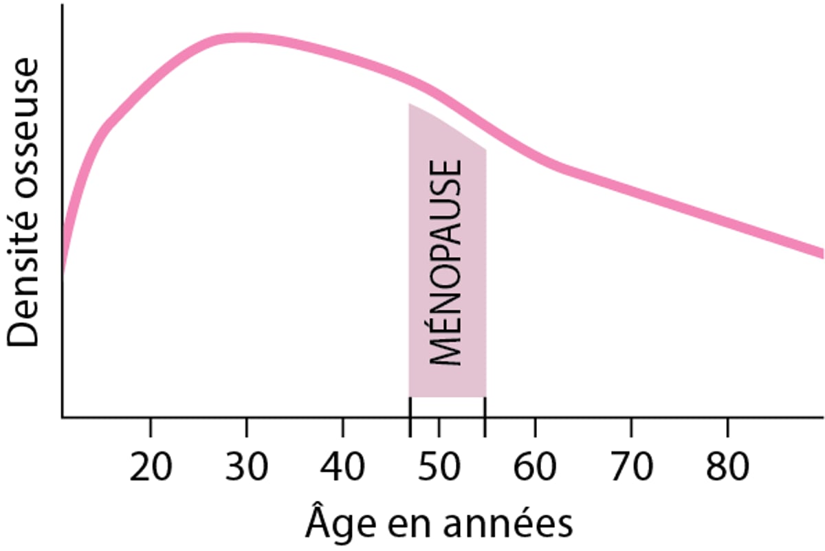 Perte de la densité osseuse chez les femmes