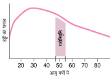 महिलाओं में हड्डियों का घनत्व कम होना