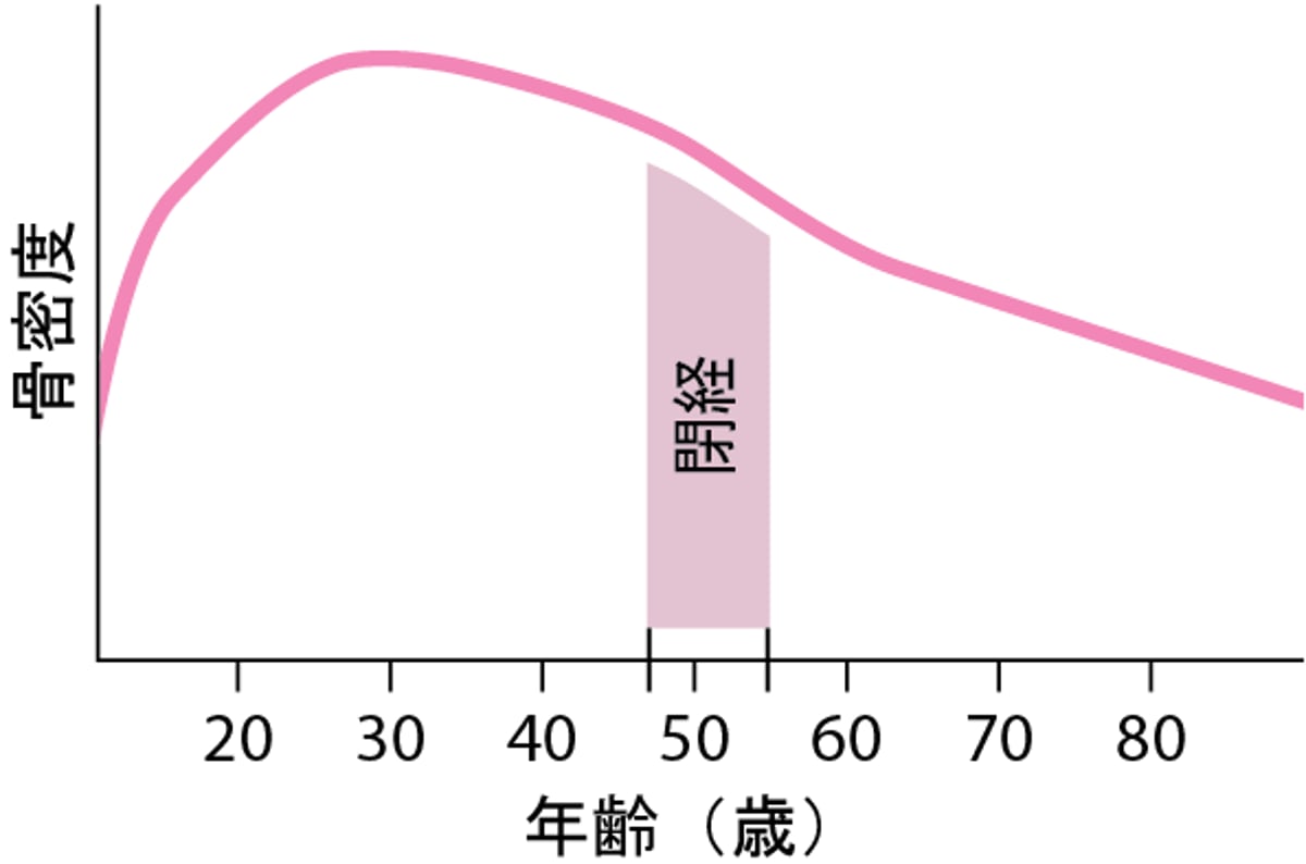 女性における骨密度の低下