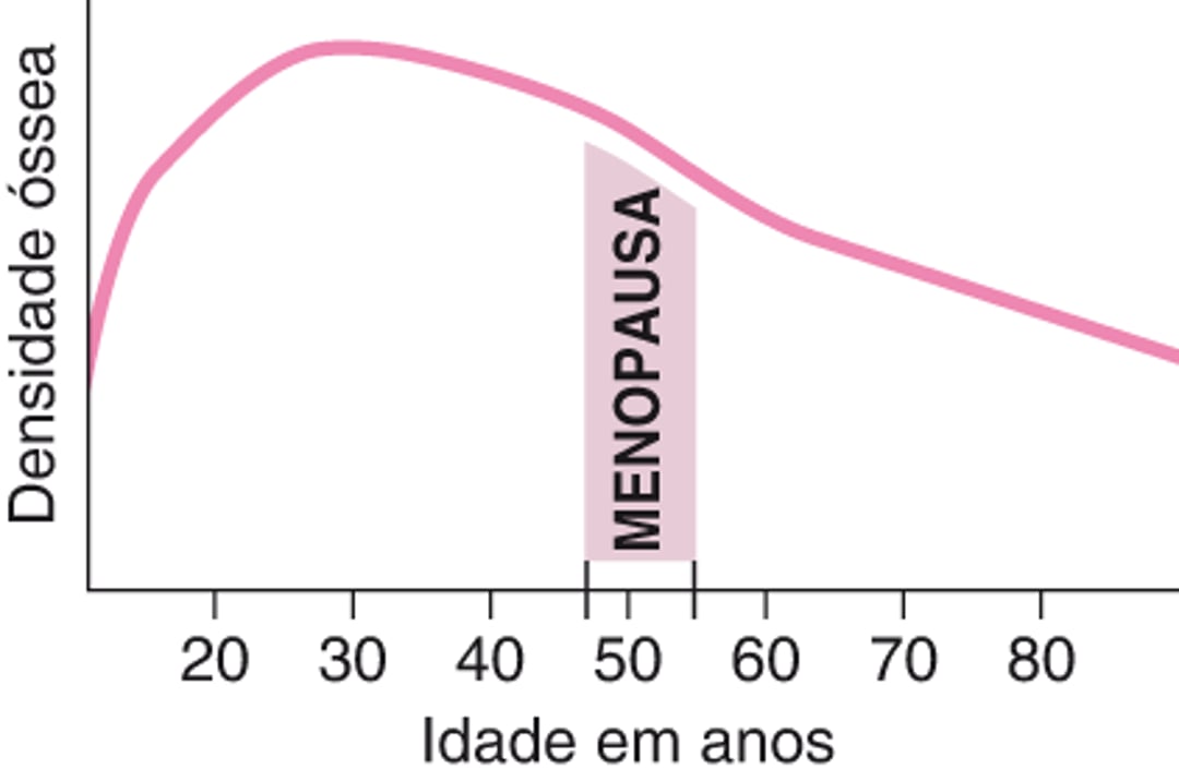 Perda de densidade óssea em mulheres