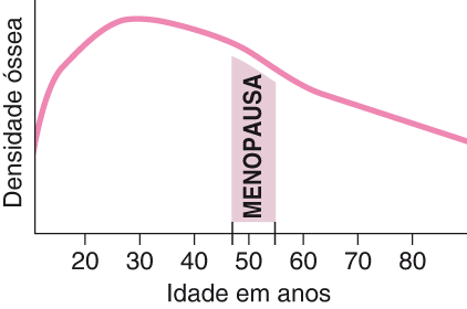 Guia sobre osteoporose: sintomas e prevenção eficaz - Visão Completa Baseada em Evidências